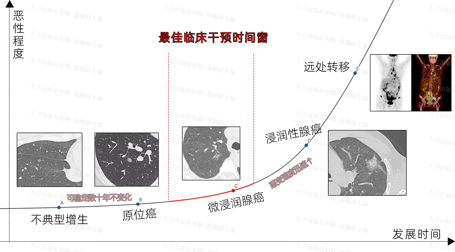 7:在适合的时机选择适合的措施,不错失最佳干预窗口期